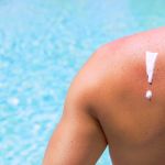 Männlicher Rücken mit Sonnencreme am Pool.