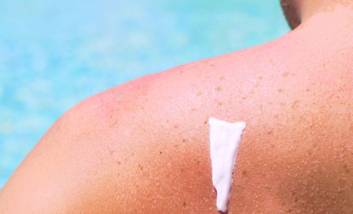 Mann mit Sonnencreme am Rücken steht am Pool.
